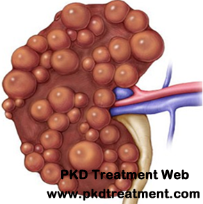 Kidney Cyst Symptoms and Treatment