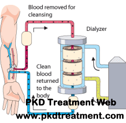 Side Effects of Dialysis in Kidney Failure