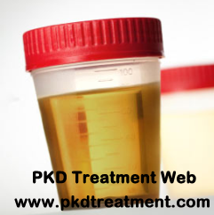 Life Expectancy for PKD Patients with Blood Urine