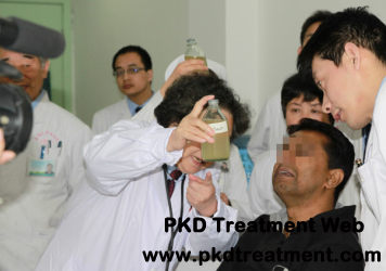 Successful Cases: Chinese Medicine is So Amazing to Treat My PKD