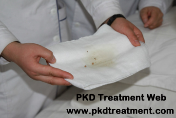 Successful Cases: Chinese Medicine is So Amazing to Treat My PKD