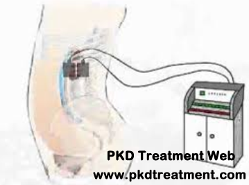Advantages of Micro-Chinese Medicine Osmotherapy in Treating PKD