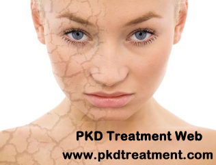 How to Treat Dry Skin in Hemodialysis