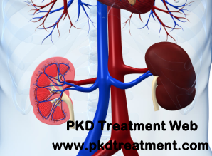 Renal Cortical Cyst: Symptoms and Treatment