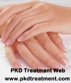 What Can I Do with Swollen Hands Related to PKD