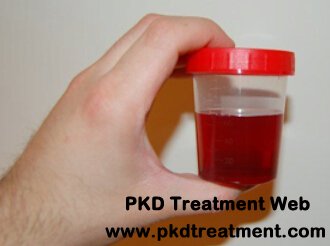 How To Stop Blood Urine In Kidney Cyst