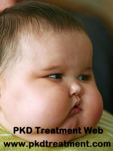 How to Deal with Swollen Face and Polycystic Kidney Disease