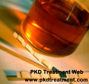 How Long Will The Hematuria Last When the Kidney Cyst Ruptures