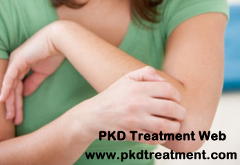 How To Relieve the Skin Itching in Dialysis
