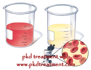 Does A Kidney Cyst Cause Gross Hematuria