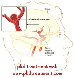 Complications of High Creatinine Level in PKD