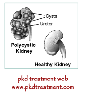  Stages of Polycystic Kidney Disease