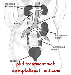 Is Kidney Transplant A Good Treatment Option for Kidney Failure
