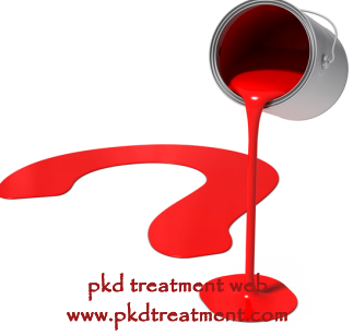 Is a 4 cm Cortical Cyst Dangerous in My Right Kidney