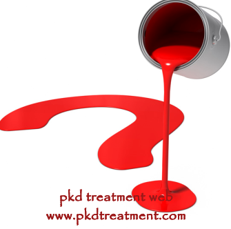 Do Kidney Cysts Need to Have Treatment