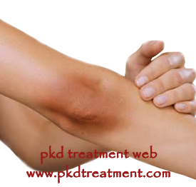 How to Prevent Darkening of Skin From PKD