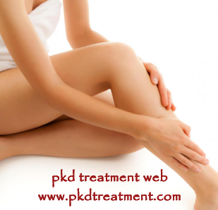 What Do Itchy Legs Mean for PKD Patients