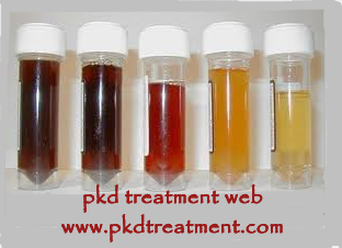 Is Rust-Colored Urine A Sign of PKD