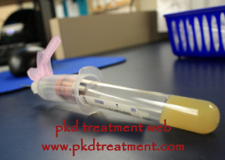 How to Treat the Low Urine Output In PKD
