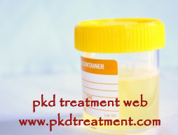 Causes And Treatment for Colorless Urine in PKD