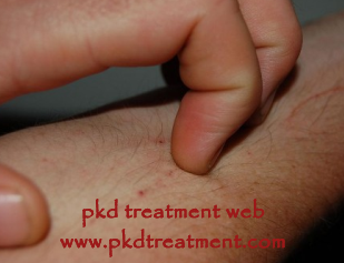 Red Spots on Legs and Arms in Kidney Failure