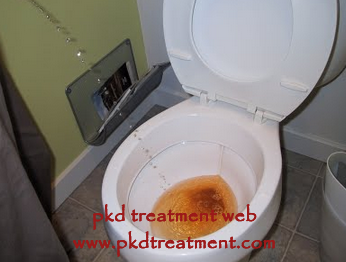 Why Does Hematuria Occurs In PKD Patients