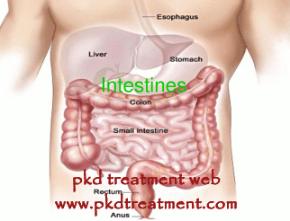 Will PKD Affect the Intestines