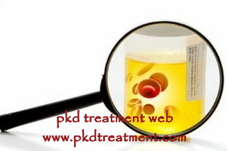 How Critical Is Blood In Urine In Case Of Polycystic Kidneys