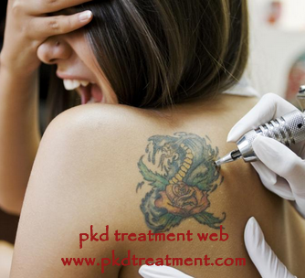 Can We Get Tattoos When We Are On Dialysis