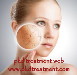 Can dialysis cause dry skin
