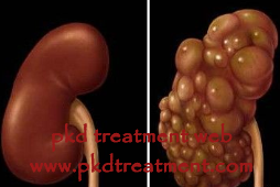 Cyst on Kidney Do I Need to Worry 