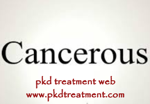 Could My Kidney Cysts Be Cancerous