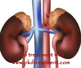 How to Treat High Creatinine Level after Kidney Transplant