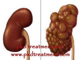 Can A Person Prevent Polycystic Kidney Disease