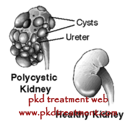 What Are The Complications of Autosomal Dominant Polycystic Kidney Disease 