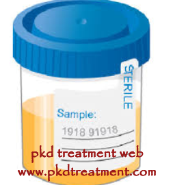 How Can My Creatinine Get Lowered 