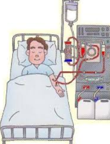 Are There Technologies That Reduce Frequency of Dialysis