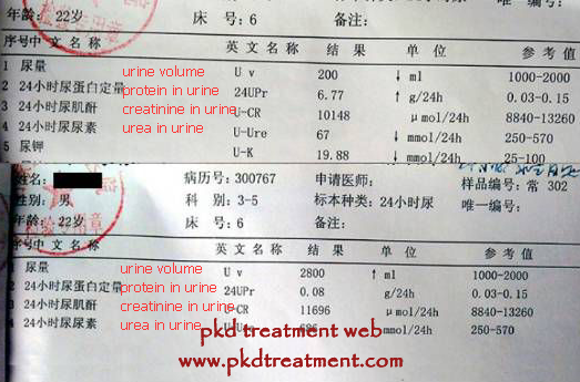 How to Treat Swelling Effectively for Kidney Failure 