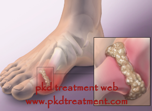 treatmen for gout and PKD