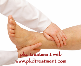 Kidney Failure With Swelling Legs Treatment